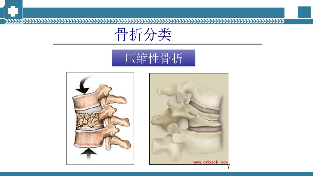 手术室腰椎手术配合PPT课件 腰椎压缩性骨折手术治疗PPT电子版7