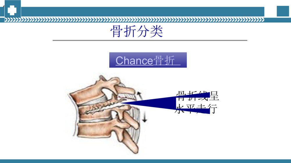 手术室腰椎手术配合PPT课件 腰椎压缩性骨折手术治疗PPT电子版9