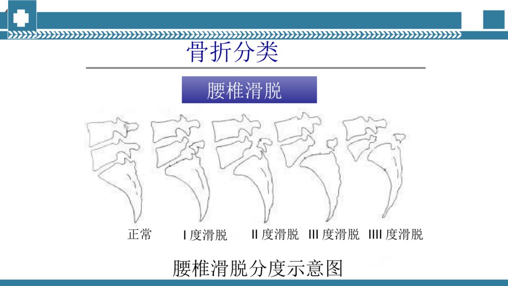 手术室腰椎手术配合PPT课件 腰椎压缩性骨折手术治疗PPT电子版10